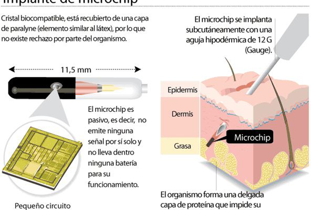 ¿Qué es el microchip?